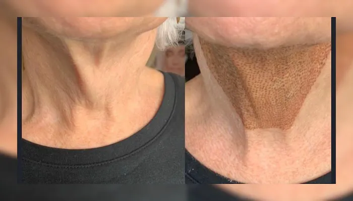 Volt Beauty Picture 5