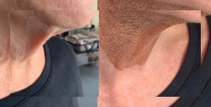 Volt Beauty Picture 6