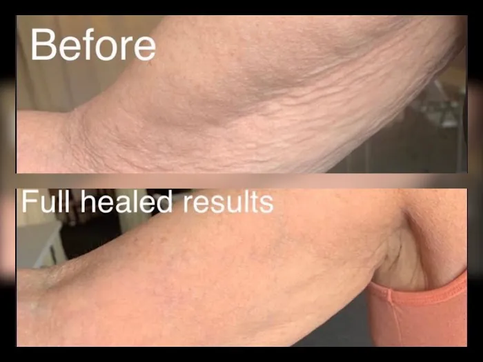 Volt Beauty Picture 9