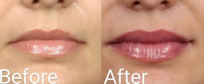 Webster Medical Aesthetics Picture 1