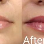 Webster Medical Aesthetics