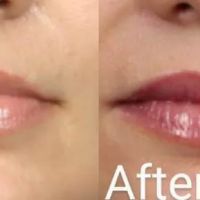 Webster Medical Aesthetics ico