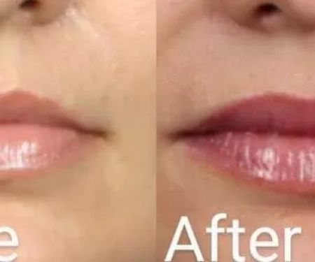 Webster Medical Aesthetics