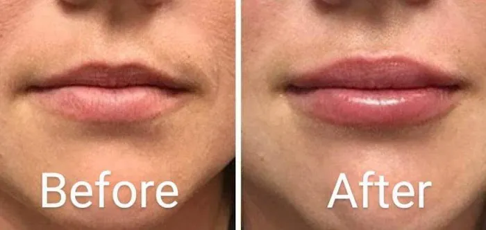 Webster Medical Aesthetics Picture 5