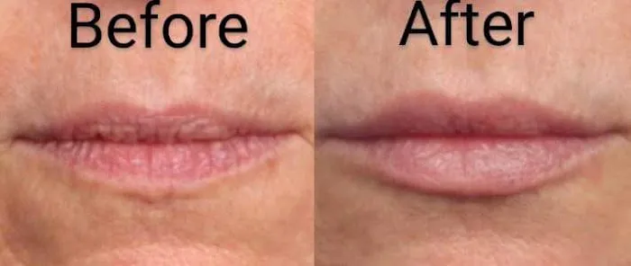 Webster Medical Aesthetics Picture 3