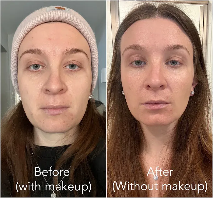 Novum Skin Picture 1