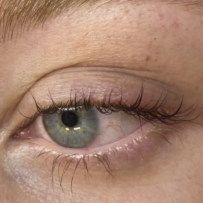 Novum Skin Picture 9