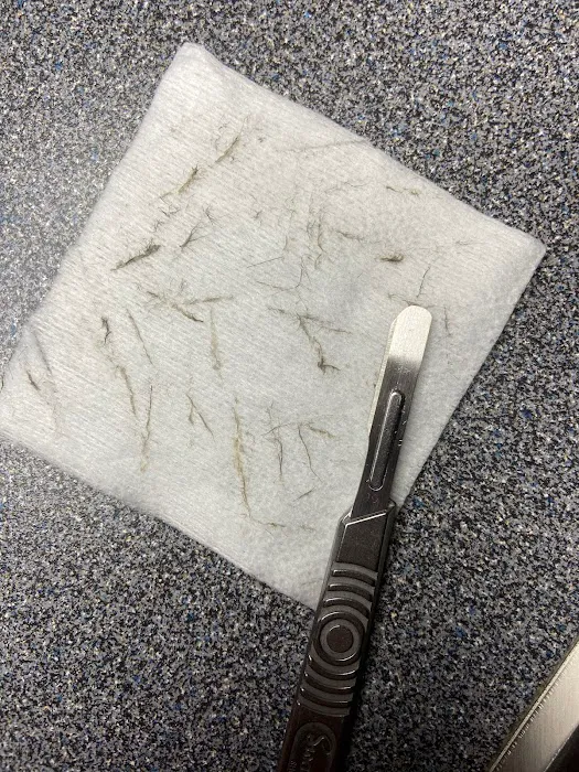 SKIN WITH LYSS Picture 1