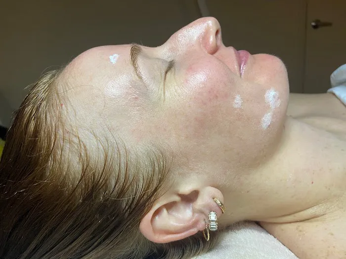 SKIN WITH LYSS Picture 3