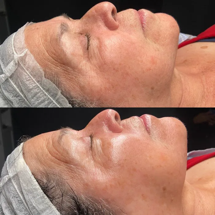 SKIN WITH LYSS Picture 5