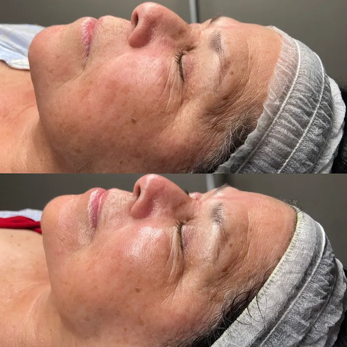 SKIN WITH LYSS Picture 9