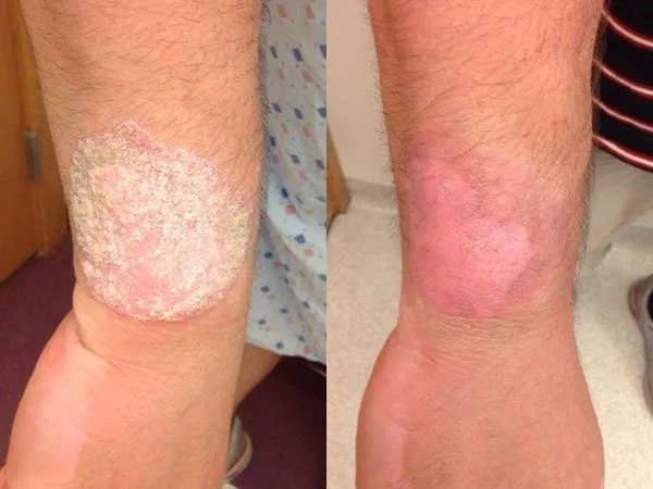 Dr Raymond Kidwell's New Private Practice- Clovis Dermatology Picture 2