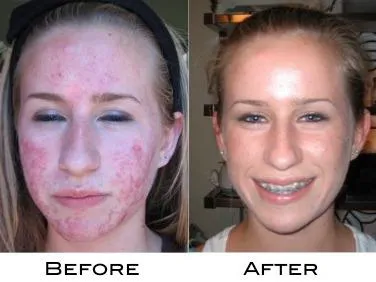 Dr Raymond Kidwell's New Private Practice- Clovis Dermatology Picture 1