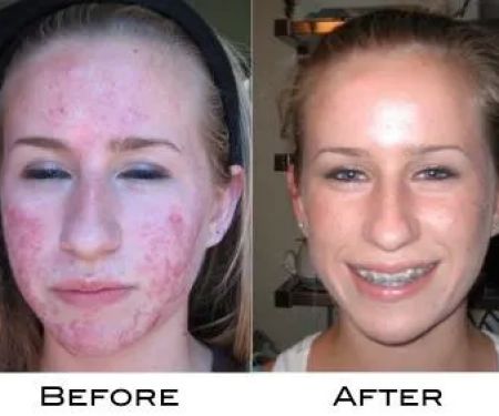 Dr Raymond Kidwell's New Private Practice- Clovis Dermatology