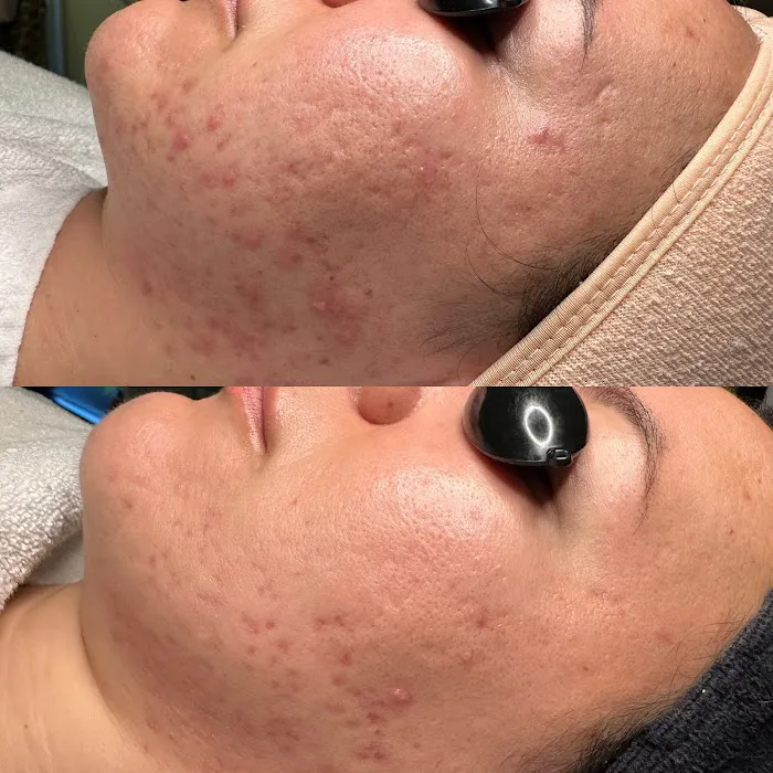 Advanced Skin Care Picture 4