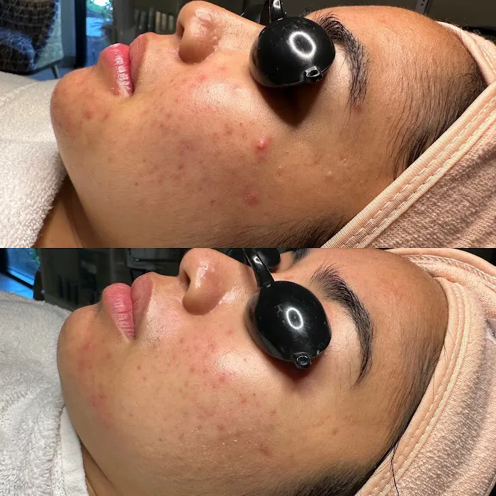 Advanced Skin Care Picture 2