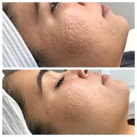 Rachel Harper Skincare ico