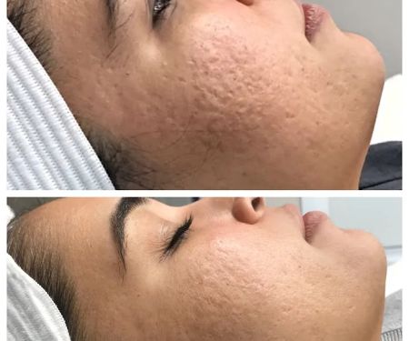 Rachel Harper Skincare