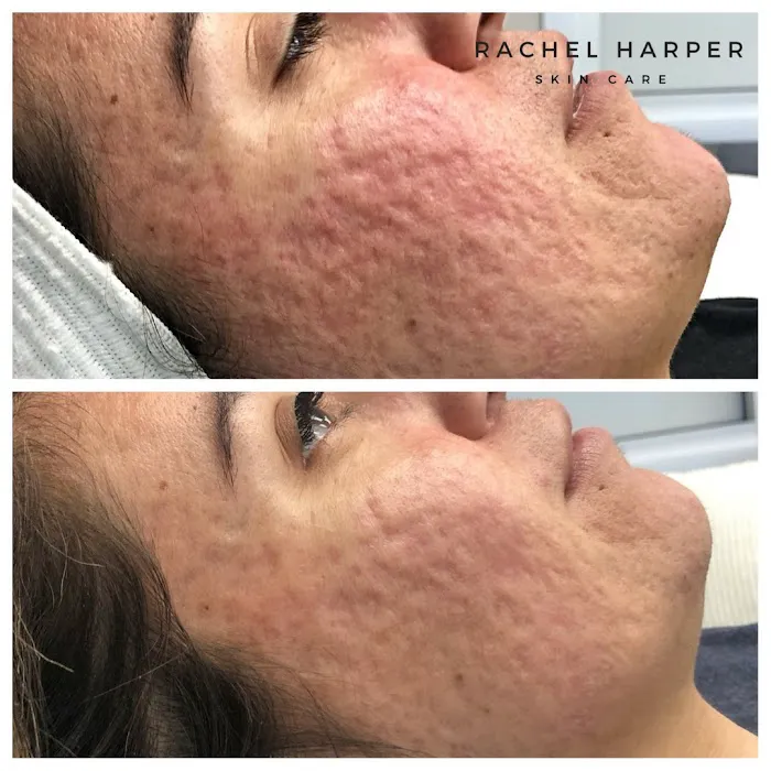 Rachel Harper Skincare Picture 5