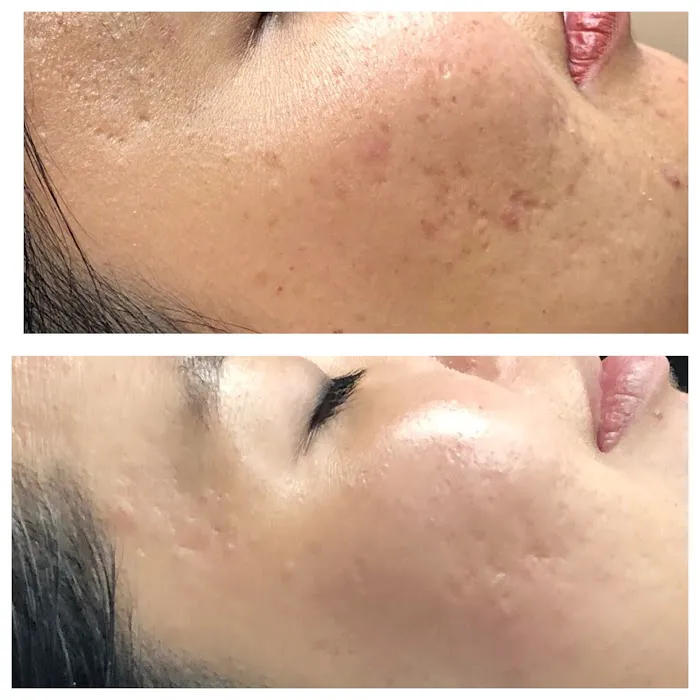 Rachel Harper Skincare Picture 4