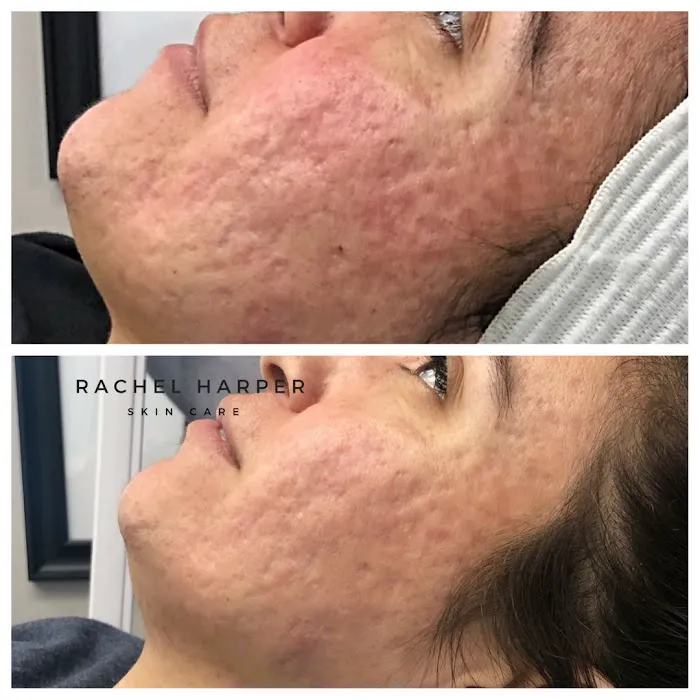 Rachel Harper Skincare Picture 6