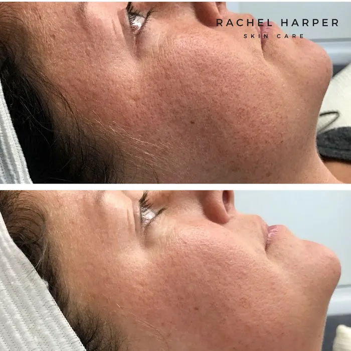 Rachel Harper Skincare Picture 9