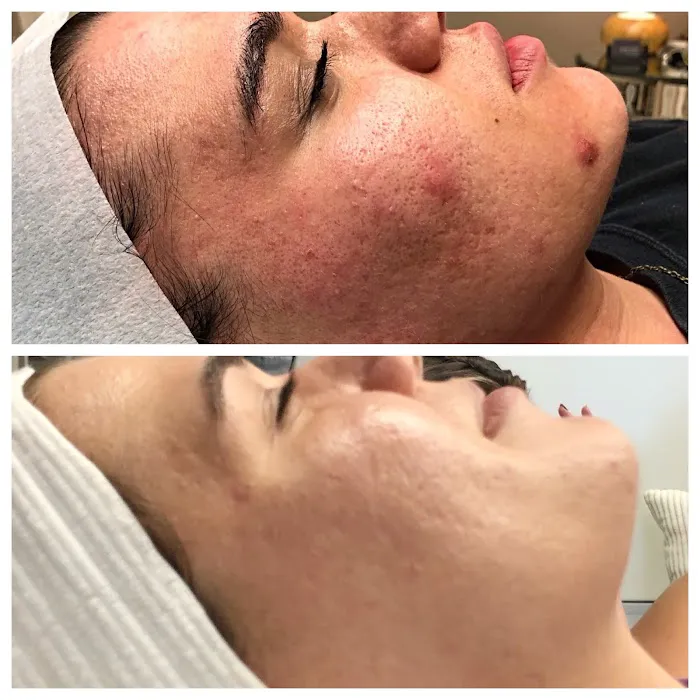 Rachel Harper Skincare Picture 10