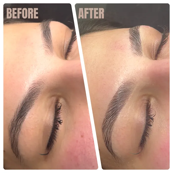 skn radiance Picture 10