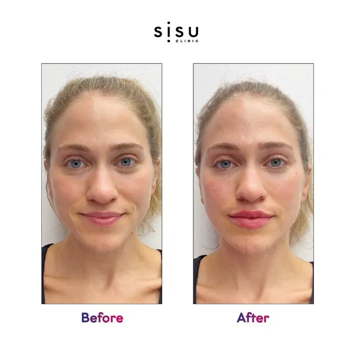 Sisu Clinic - Houston Picture 8