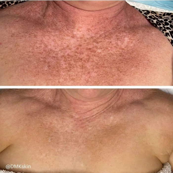 Skincare & Bodywork By Amanda Barrera Picture 8