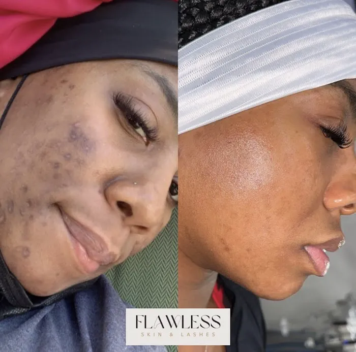 Flawless Skin and Lashes Picture 7