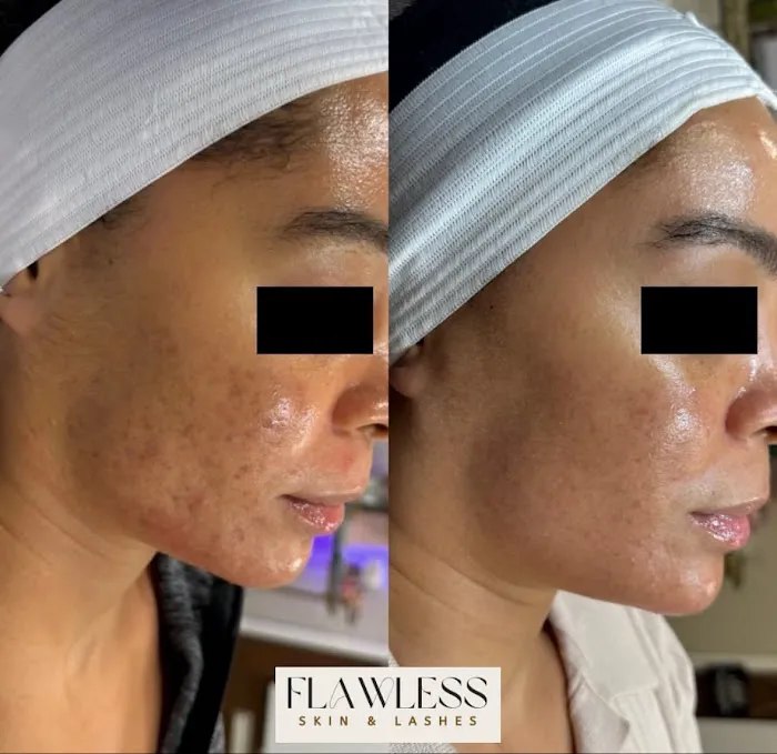 Flawless Skin and Lashes Picture 2