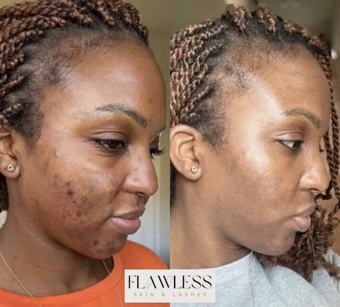 Flawless Skin and Lashes Picture 9