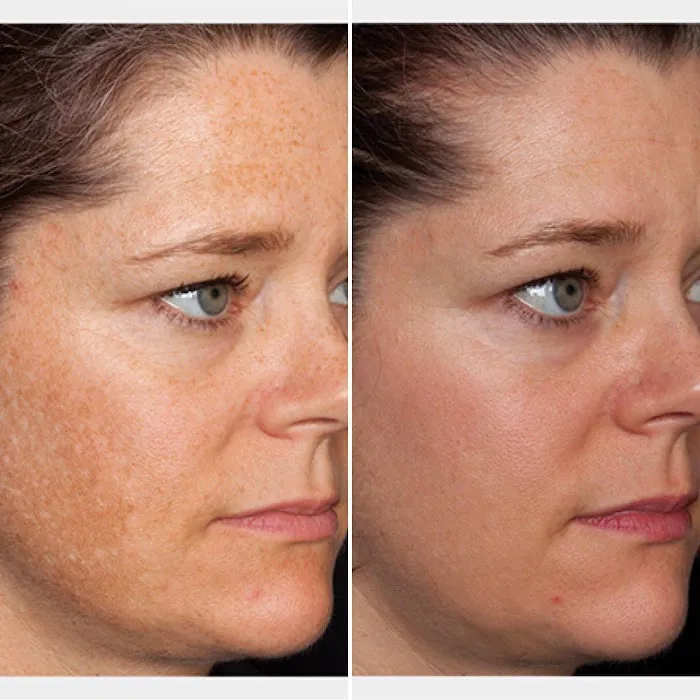 Abby The Esthetician Picture 10