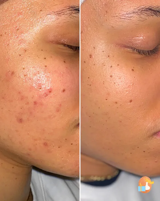 Care Package Spa Picture 7