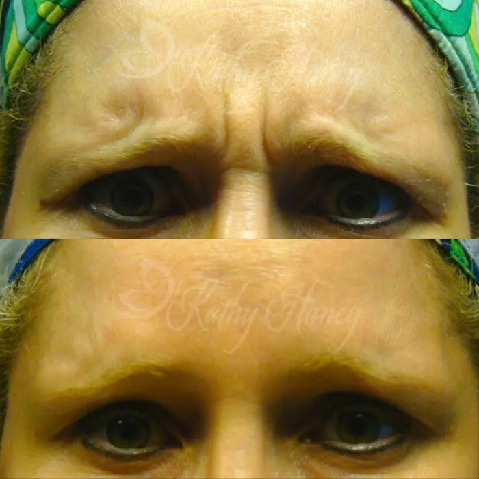 Kathy Haney, Medical Aesthetician Picture 2