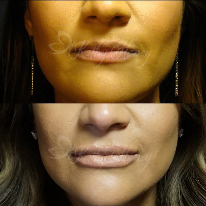 Kathy Haney, Medical Aesthetician Picture 10