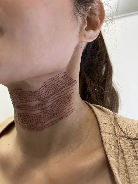 Cloverderm Picture 2