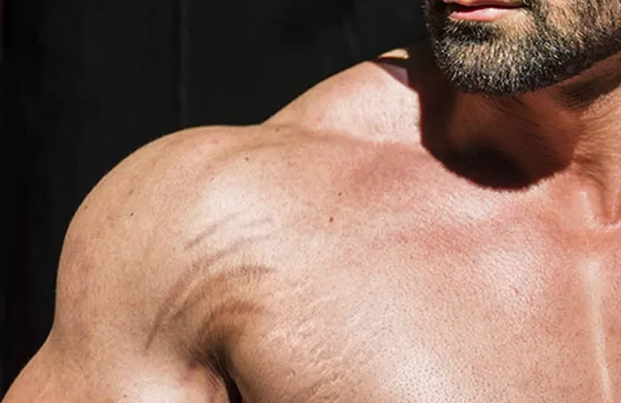 Cloverderm Picture 4