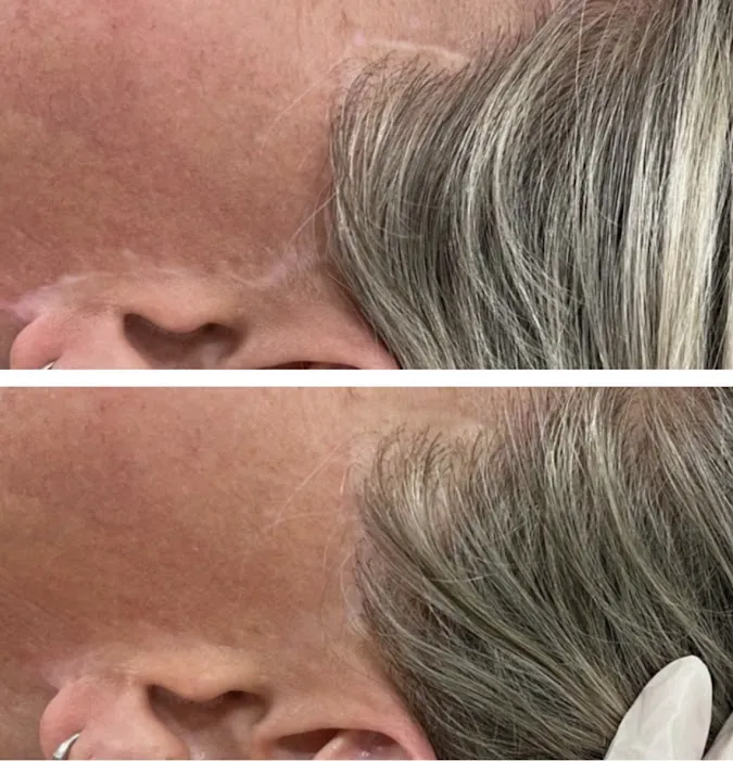 Cloverderm Picture 5