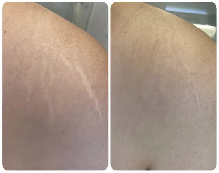 Cloverderm Picture 9