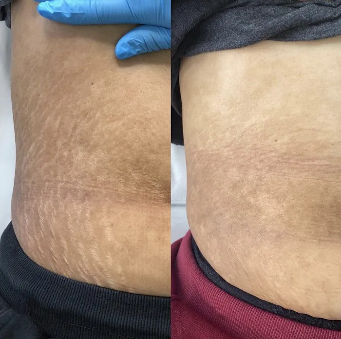 Cloverderm Picture 10