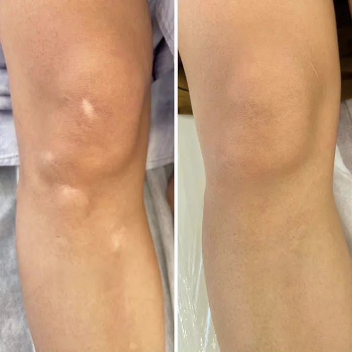 Cloverderm Picture 7