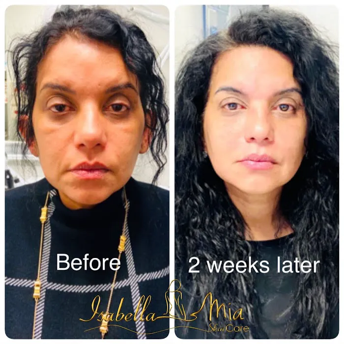 Isabella Mia Skin Care Picture 2