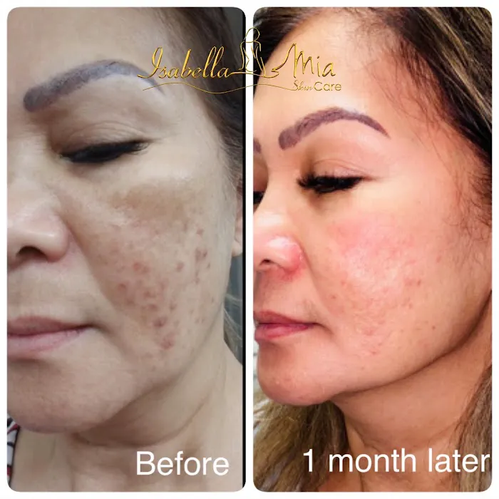 Isabella Mia Skin Care Picture 6