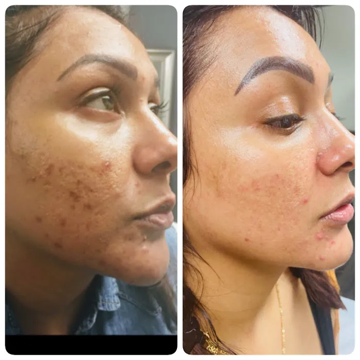 Isabella Mia Skin Care Picture 3