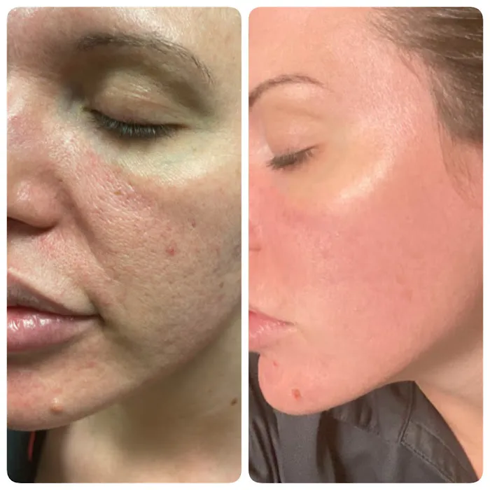 Isabella Mia Skin Care Picture 9