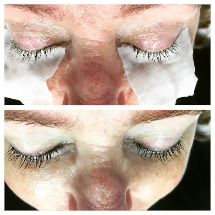 Spa Zoey Skin Care Picture 8