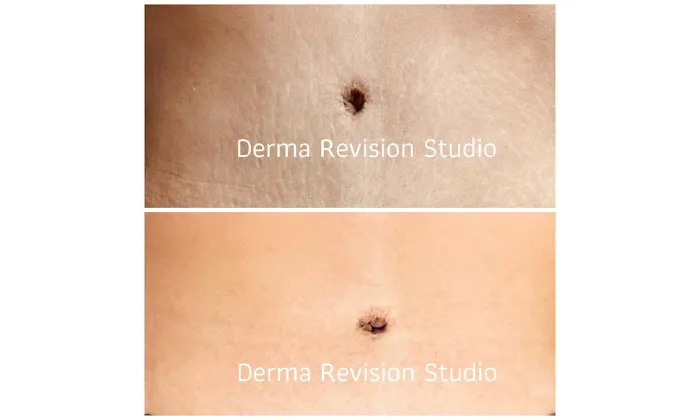 Derma Revision Studio Picture 1