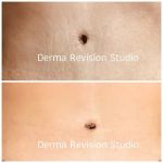 Derma Revision Studio